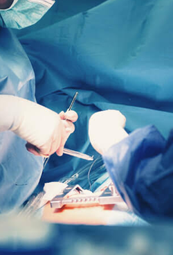 general surgery in guntur